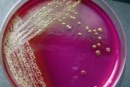 Etude bactériologique sur l’hygiène dans les toilettes du Collège, des résultats interpellants