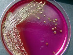 Escherichia Coli